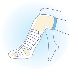 ADV AQUAGUARD CAST BANDAGE PROTECTOR ADULT FULL LEG