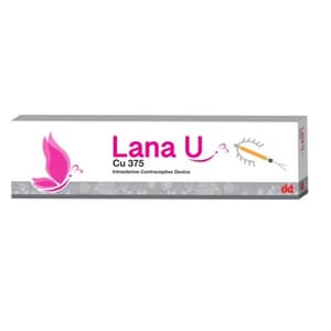 لانا يو (إنارا) جهاز داخل الرحم لمنع الحمل